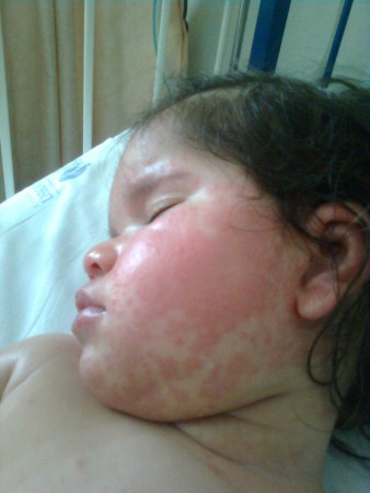 Fevereiro 2012 - Hospital Stª Maria